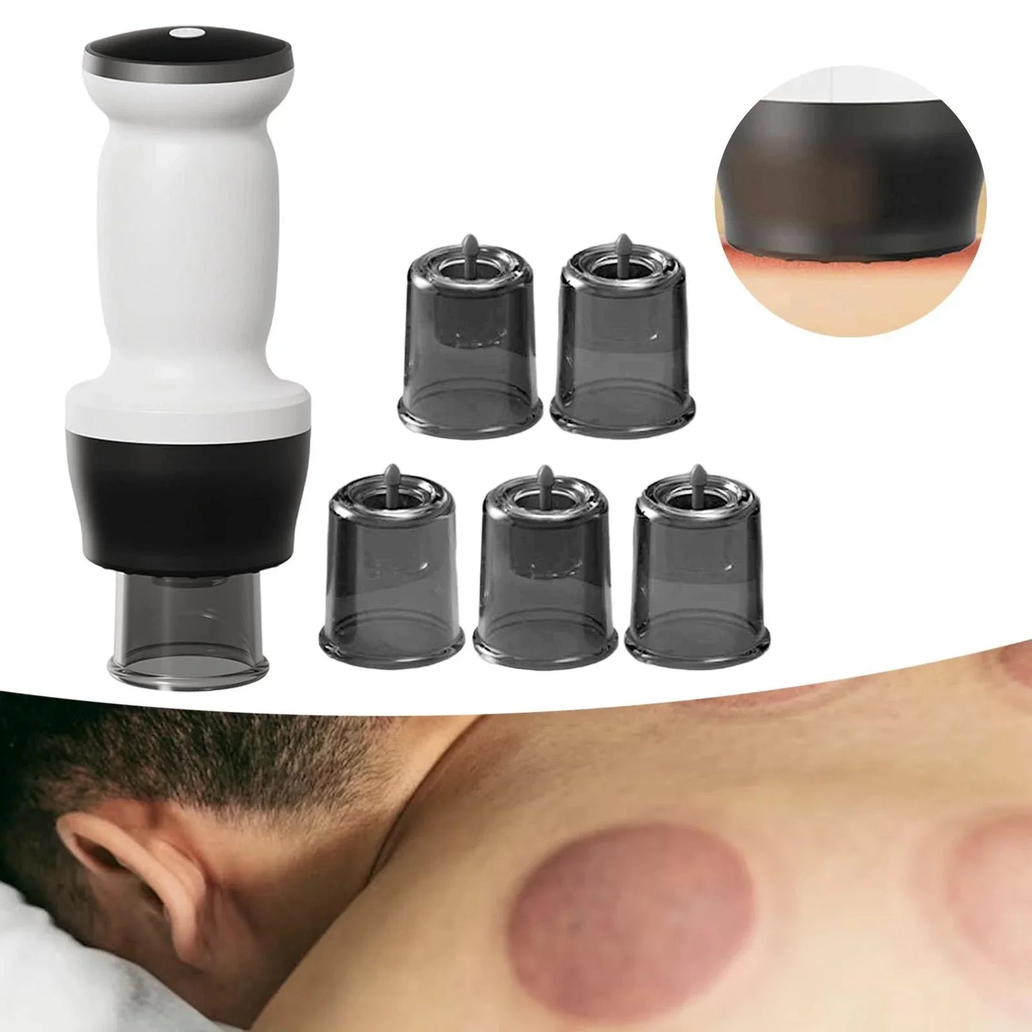 Intelligent Negative Pressure Cupping Massage Instrument for Muscle Relief